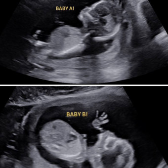 Samuel & Trisha's Baby Registry Photo.