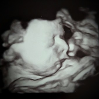 Baby Eddy's Registry👶🏼 Photo.
