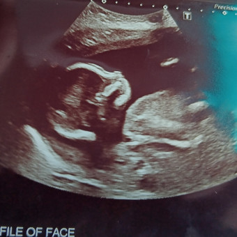 Bigby Baby Registry Photo.