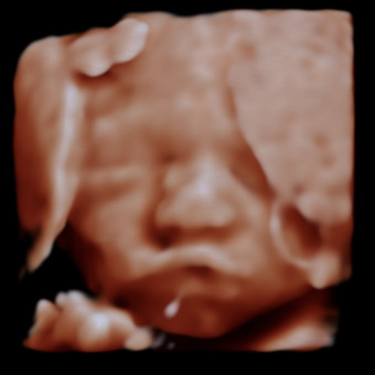 Arabella's Baby Registry Photo.