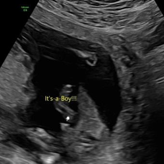 Gabrielle's Baby Registry Photo.