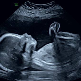 Alexis & Jordan's Baby Registry Photo.