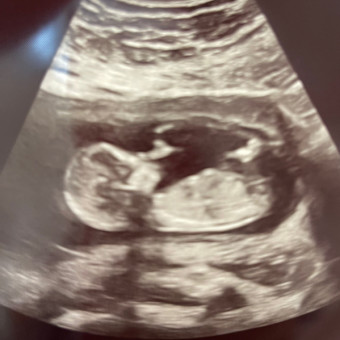 Emersyn Claire Photo.