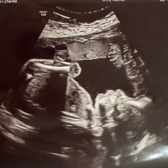 Shelby's Baby Registry Photo.