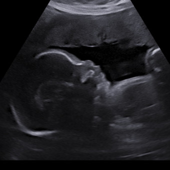 Rachelle & Russell’s Baby Registry Photo.