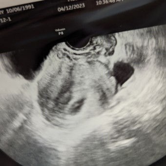 ArgenBaby2 Photo.