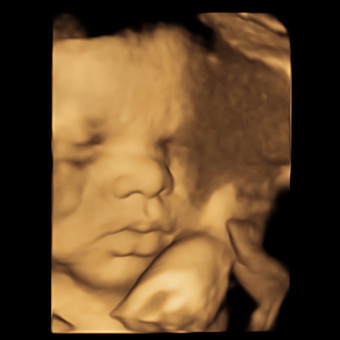 Kristel's Baby Registry Photo.