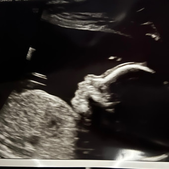 Aly's Baby Registry Photo.