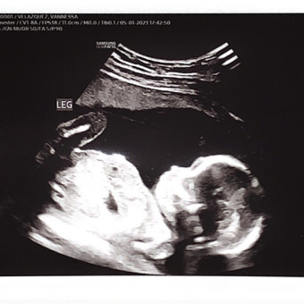 VANNESSA's Baby Registry Photo.