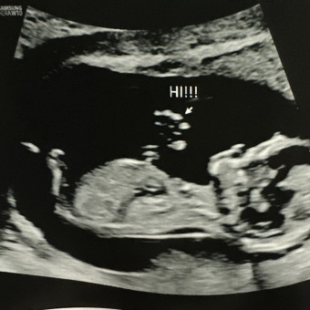 Jennifer's Baby Registry Photo.
