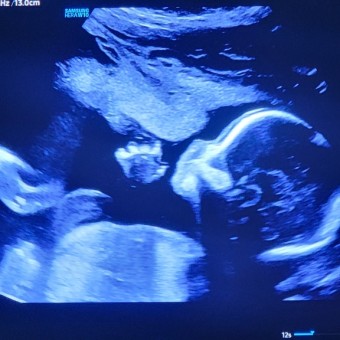 Adelyn's Baby Registry Photo.