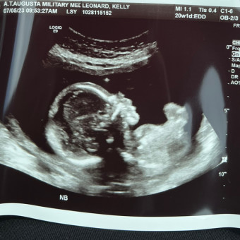 Fletcher James Photo.