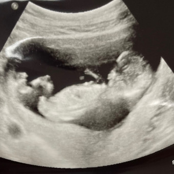 Alice & Danny's Baby Registry Photo.