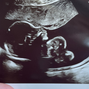 Rayne's Baby Registry Photo.