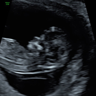 Leslie's Baby Registry Photo.