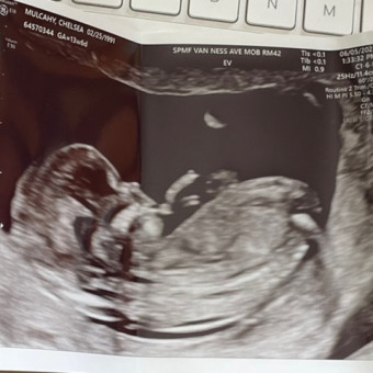 Chelsea's Baby Registry Photo.