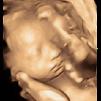Alyssa & Devin's Baby Registry Photo.