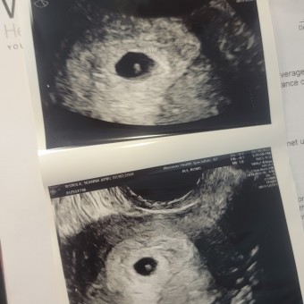 Seanna's Baby Registry Photo.