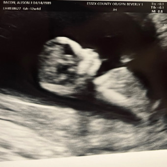 Alison's Baby Registry Photo.