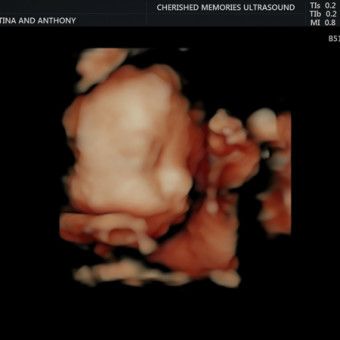 Baby Girl Tomasso Photo.