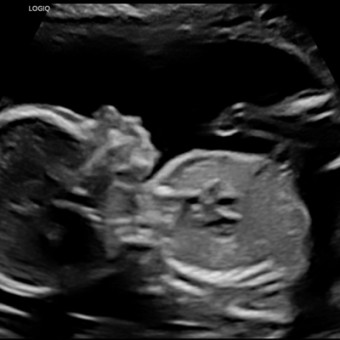 Rae + Joe’s Baby Registry Photo.