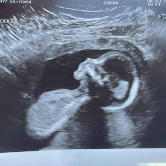 Una's Baby Registry Photo.