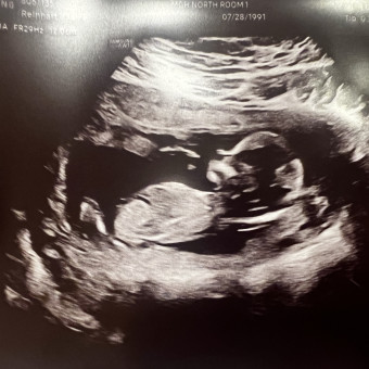 Claire & Hank's Baby Registry Photo.