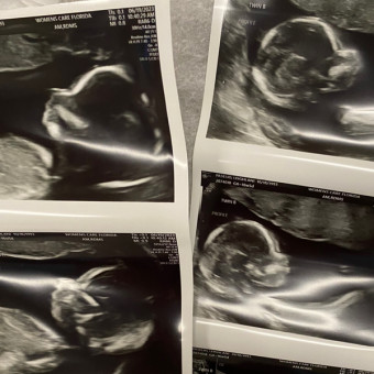 Leighlani's Baby Registry Photo.
