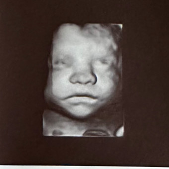 Bayle's Baby Registry Photo.
