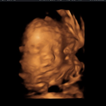 Payton Ray Gabe Goza Registry Photo.