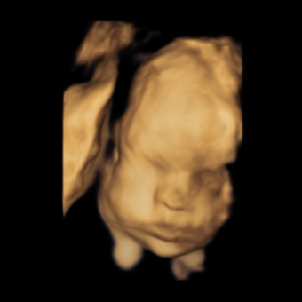 Kyrsten's Baby Registry Photo.