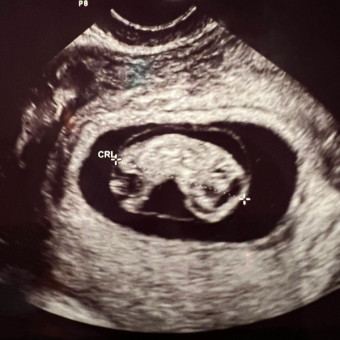 Cassie's Baby List Photo.