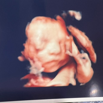Alexis&Caleb's Baby Registry Photo.