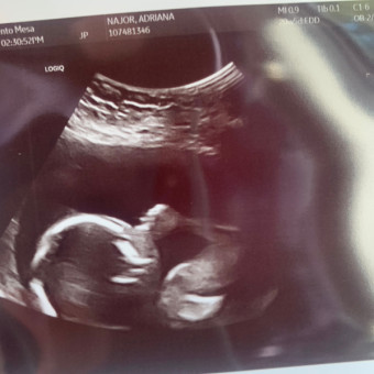 Adriana's Baby Registry Photo.