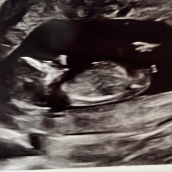 Lindsey's Baby Registry Photo.
