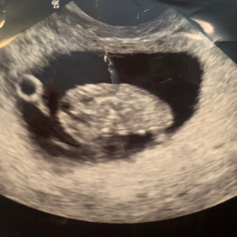 Kimberly & Devon’s Baby Registry Photo.