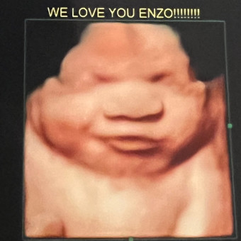Baby Enzo’s Registry Photo.