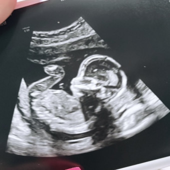 Aly's Baby Registry Photo.