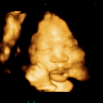 Hazel's Baby Registry Photo.