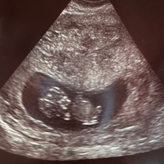 Baby Heston’s Baby Registry Photo.