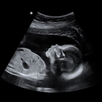 Kendra's Baby Registry Photo.
