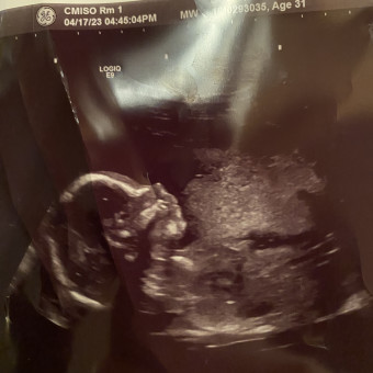 Alexa's Baby Registry Photo.