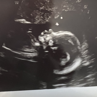 Alexis's Baby Registry Photo.