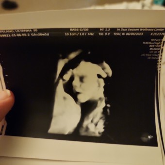 Lilyanna's Baby Registry Photo.