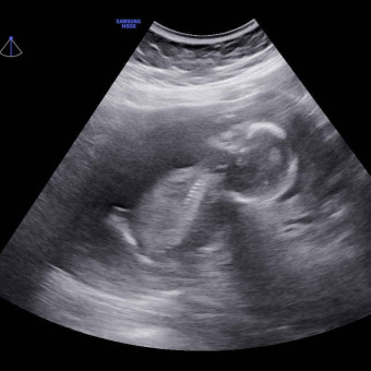 Kyhla's Baby Registry Photo.