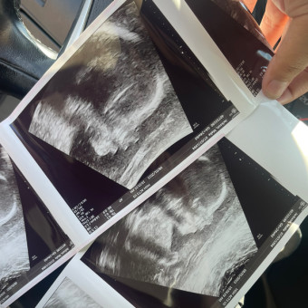 Malie's Baby Registry Photo.