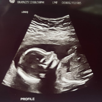 Baby #2 Photo.