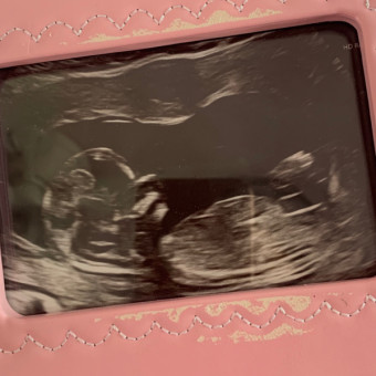 Lila's Baby Registry Photo.