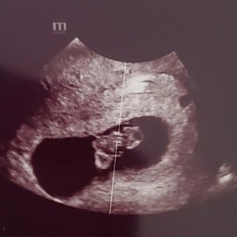 Jessica's Baby Registry Photo.