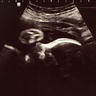 Fenske Baby Registry Photo.